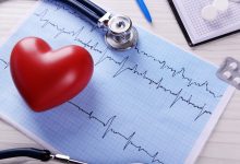 Fibrilacija atrija (AFIB) i visoki tlak su najčešći rizični faktori za bolesti srca i nastanak moždanog udara