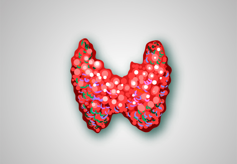 bolesti štitnjače, zlijezda, stitnjaca, tireotoksikoza, hipotireoza