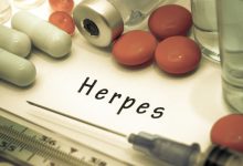 Herpes zoster: Uzroci, simptomi i liječenje virusne infekcije