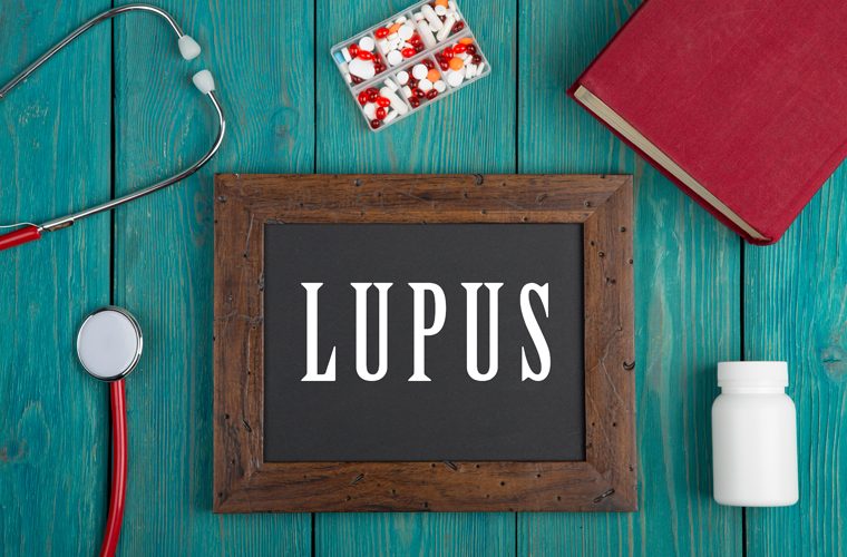 lupus je autoimuna bolest a ovo su najčešći simptomi